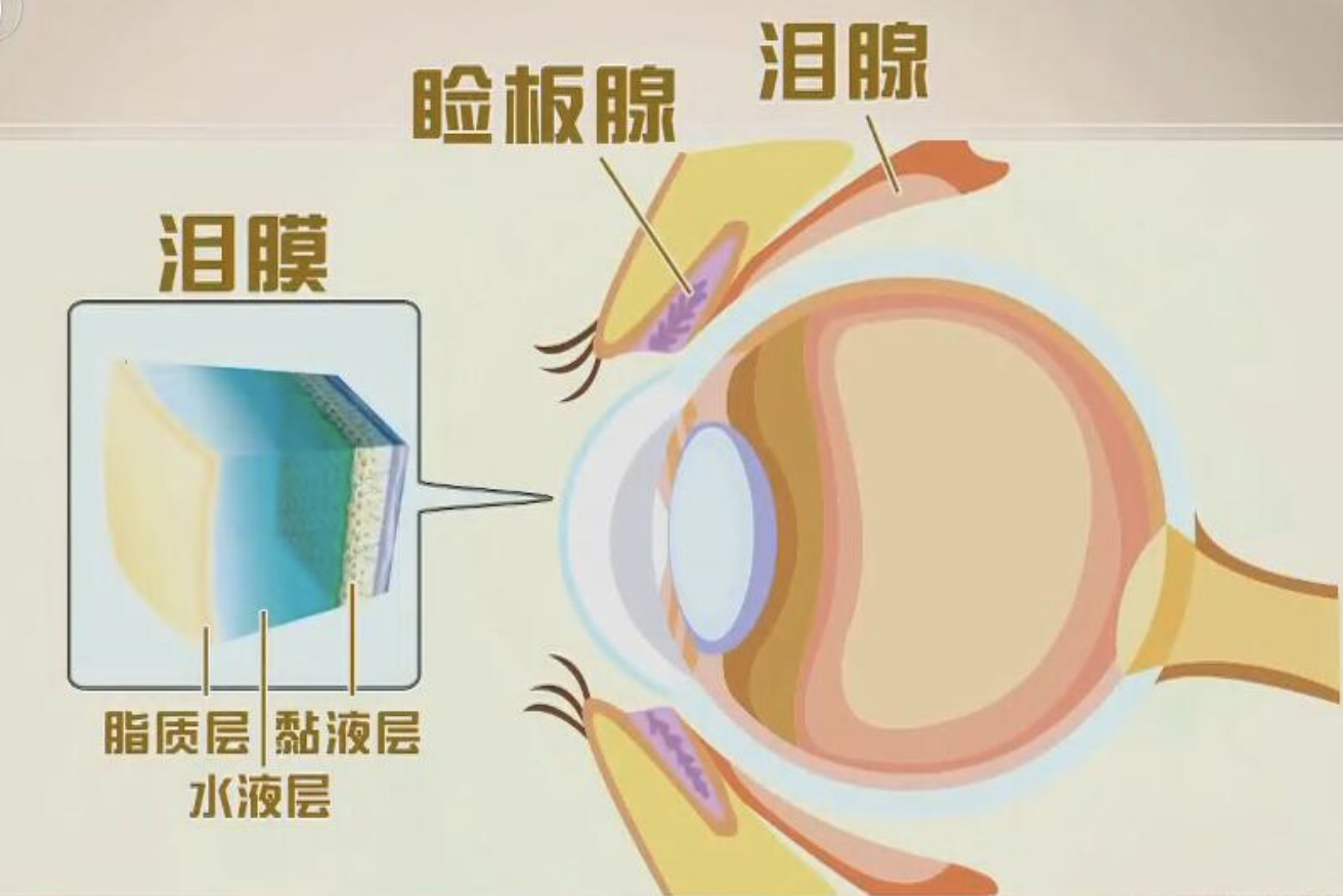 乾眼症都有哪些階段對應症狀是什麼