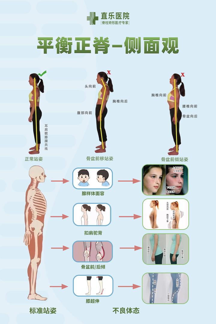 弯腰驼背体态差,根源可能在这里 - 知乎