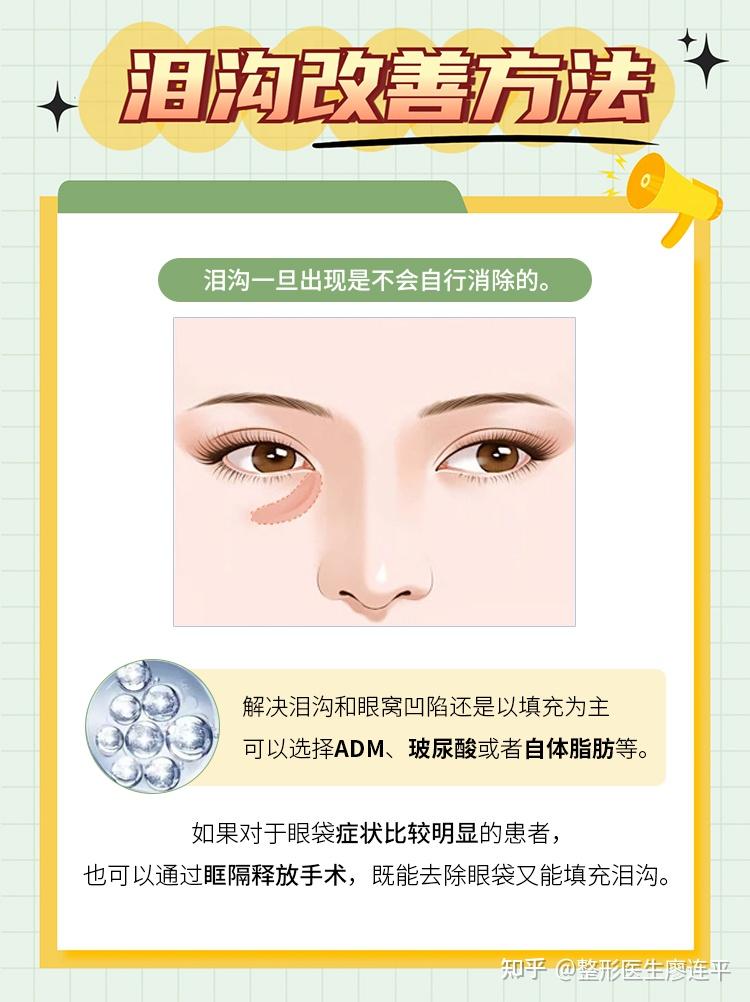 泪沟显老？必看的超全泪沟攻略来咯！ - 知乎