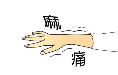 中风的前兆有什么症状? - 知乎