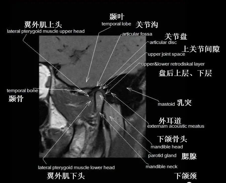 颞颌关节解剖及高清影像 - 知乎