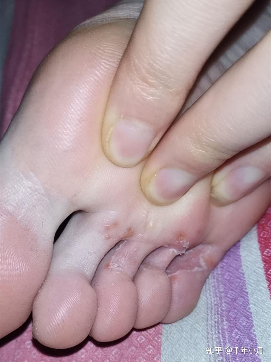 我觉得我的脚丫子有点酸臭酸臭的要怎么把脚变香啊