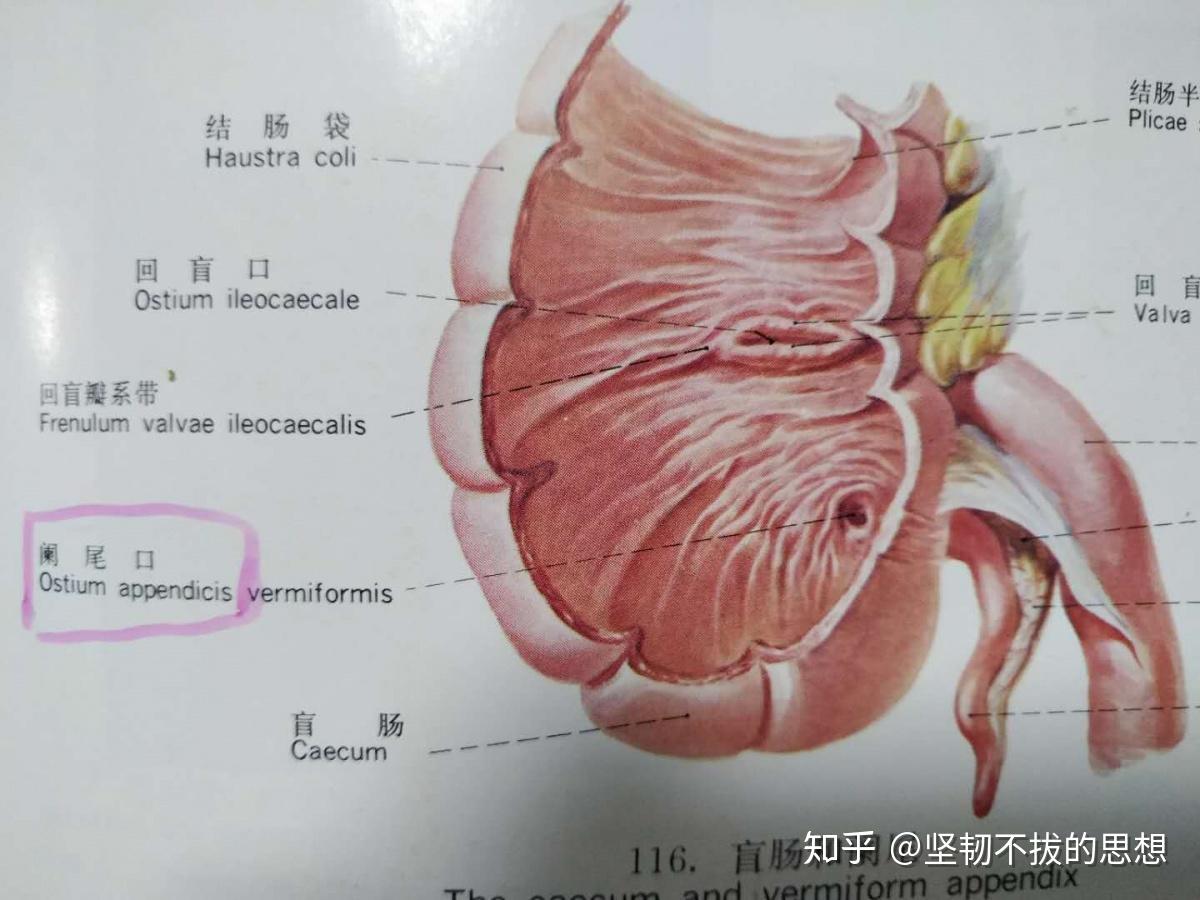 【附图】 腹腔镜直肠癌根治术（Miles术） _外科手术学 | 天山医学院