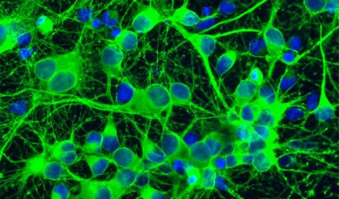 科学家在星形胶质细胞活体成像研究中获进展