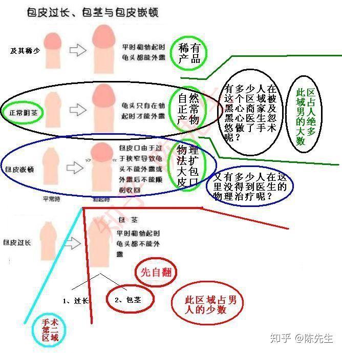 到底要不要割包皮