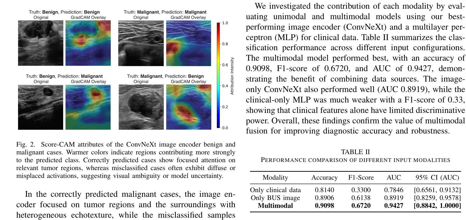 医学影像/Breast Ultrasound