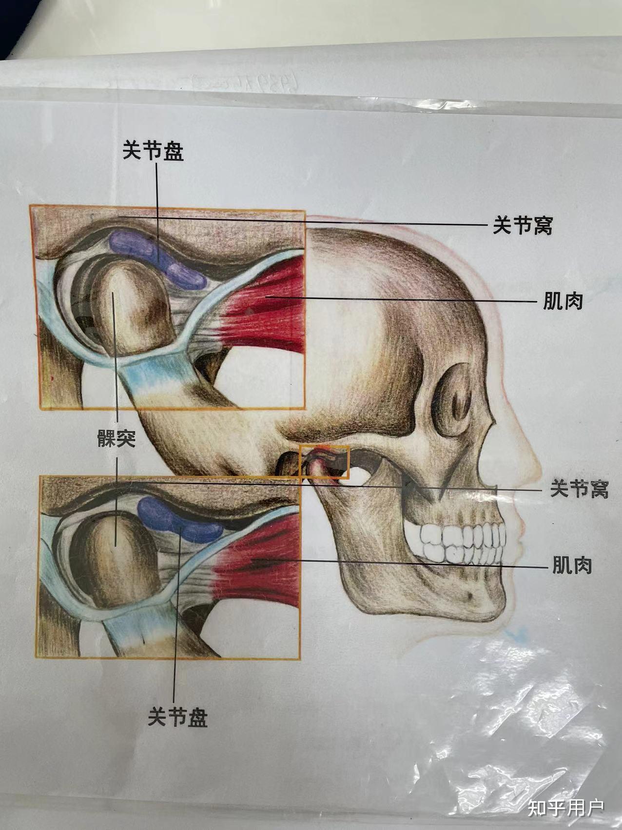 髁突和關節盤相對移位是什麼意思