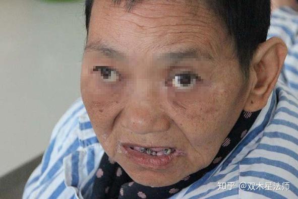 精神病治好的概率多少啊知乎的简单介绍