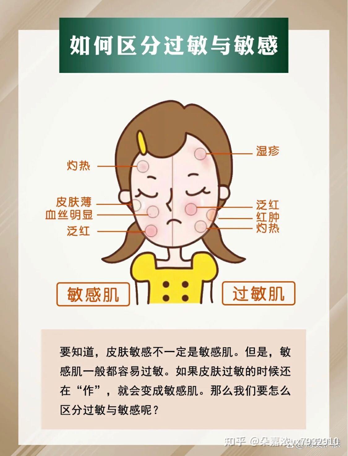 激素脸反反复复好不了,怎么对症修复?