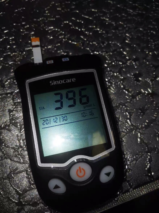 网上买的尿酸测试仪不知道准吗三诺公司出的