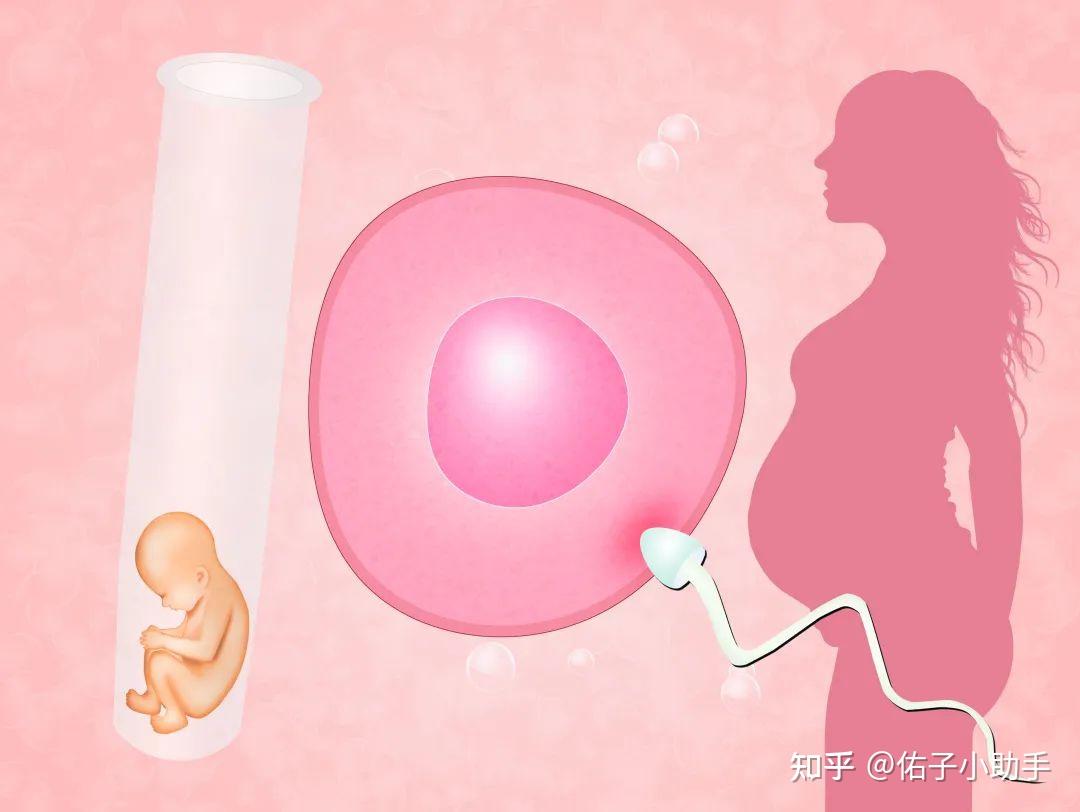 女性双子宫之谜：从形成到影响，一次说清！ - 知乎