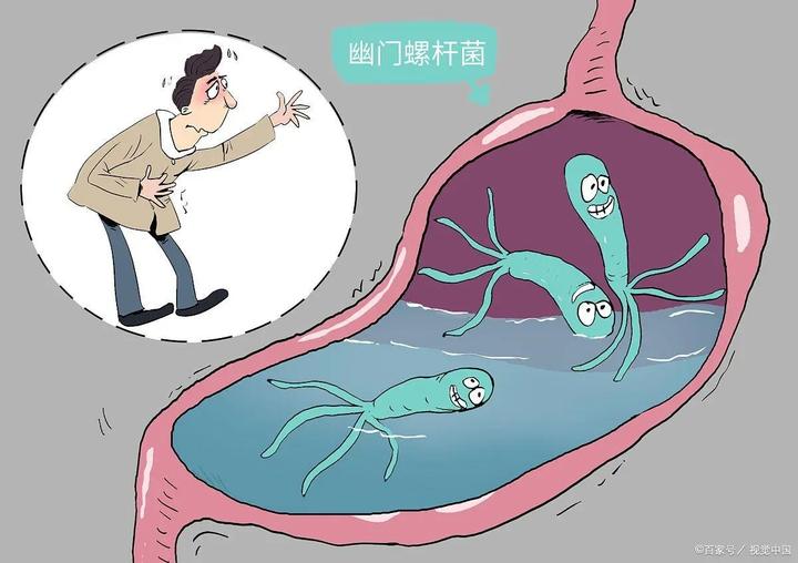 幽门螺杆菌有哪些危害?什么情况需要根除幽门螺杆菌 - 知乎