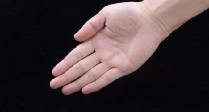 女人手心老出汗小心这6个原因