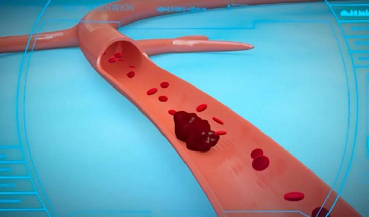 解剖235具新冠尸体的德国老法医告诉你新冠病毒是如何侵害人体的