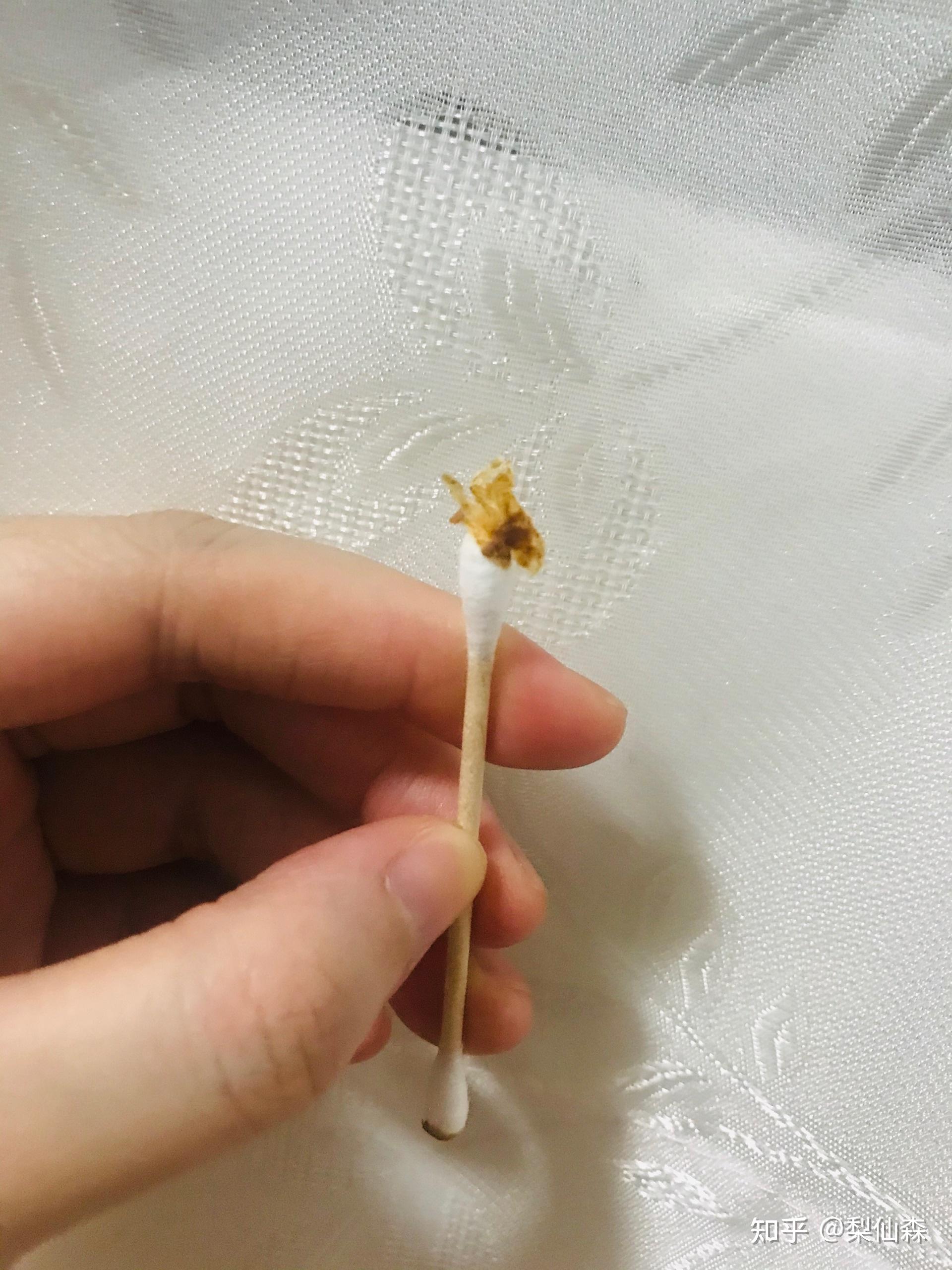 如何把在耳朵深处的耳屎弄出来