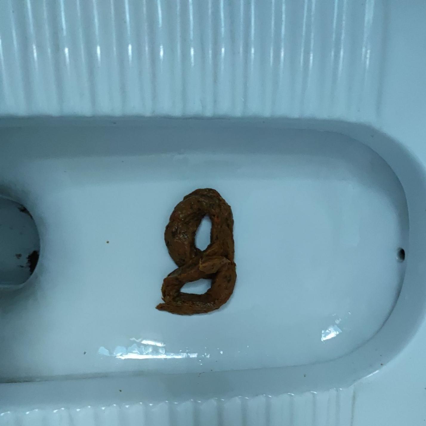 大家都拉出过什么奇怪形状的屎