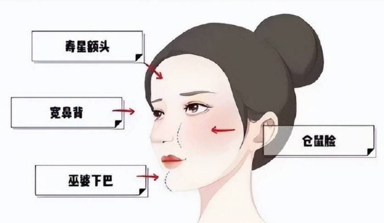 韩可旺馒化修复核心技术：SmileFace可视化取馒术原理+适用人群 - 耐看网