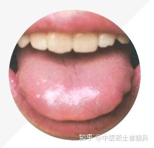 史上最全舌诊图谱!【珍藏版】 - 知乎