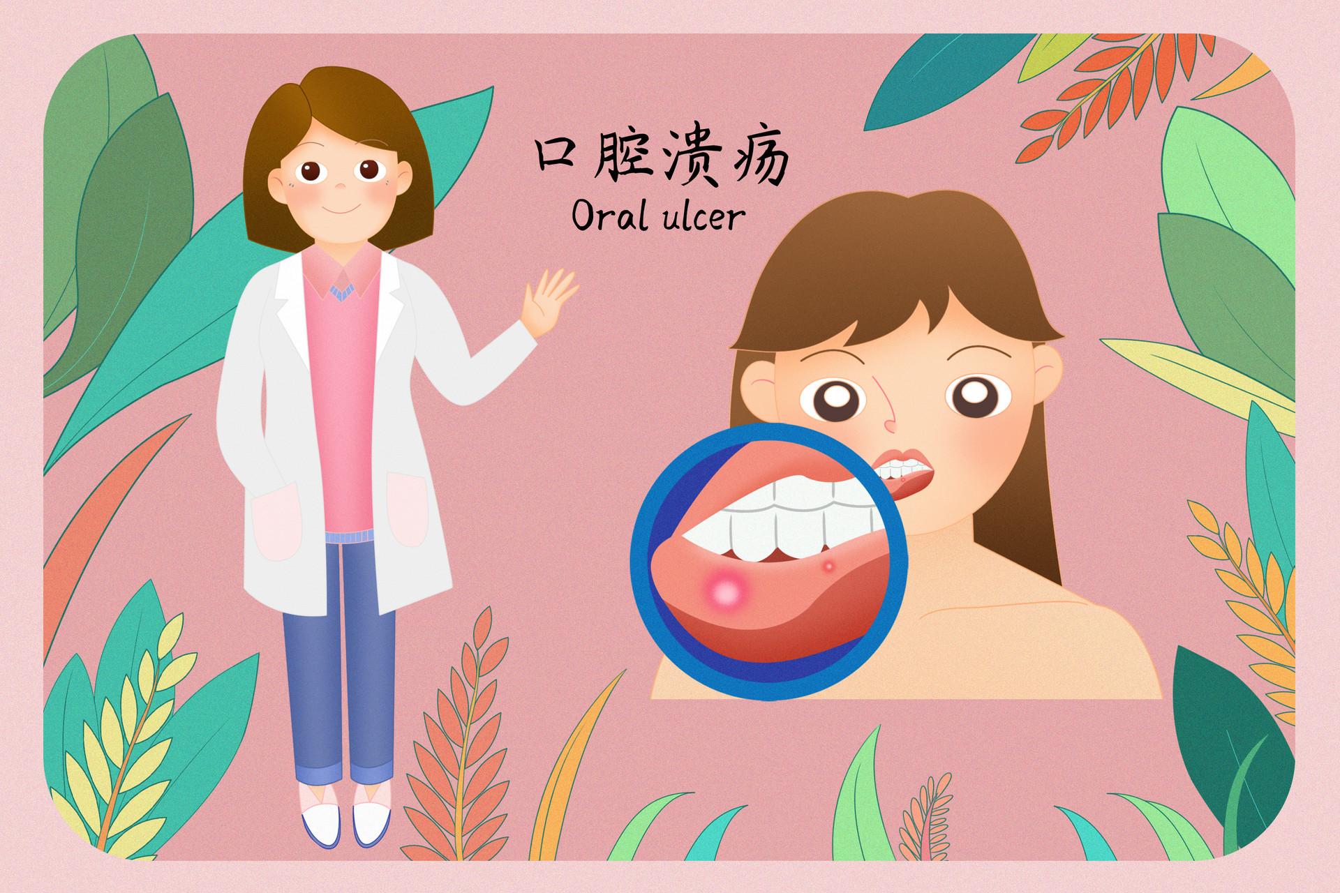 儿童口腔溃疡怎么治疗_张雷医生视频讲解口腔科疾病-快速问医生