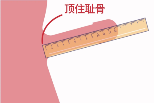 为何要从耻骨处测量男性生殖器长度