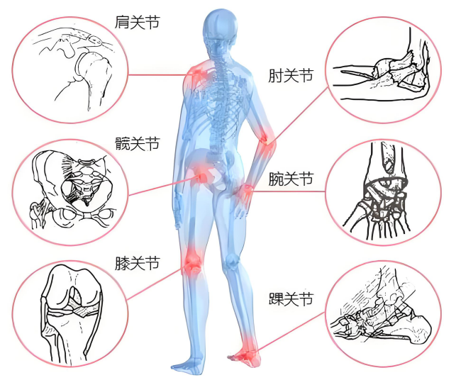 骨关节健康：全面了解与预防骨关节炎 知乎 