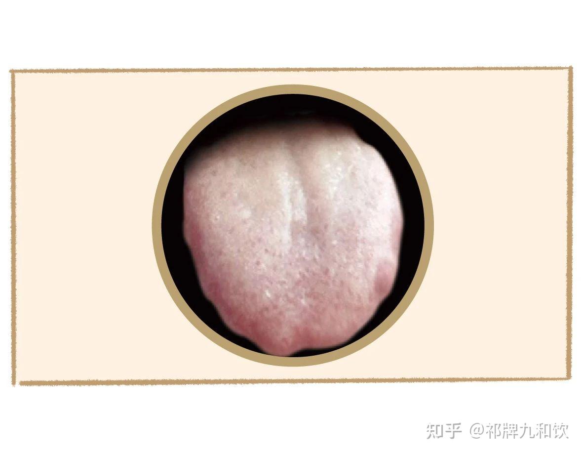中医舌诊图谱来啦！看舌头知健康 通过舌象看看你是什么体质？ - 知乎