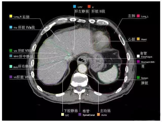 外科医生阅片能力:看完它,再也没有看不懂的腹部CT - 知乎