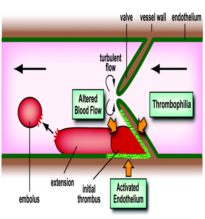 药剂师学习笔记之抗凝血药(Anticoagulants & Antiplatelets) - 知乎