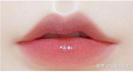 do唇前必看“唇部美学解析 - 知乎
