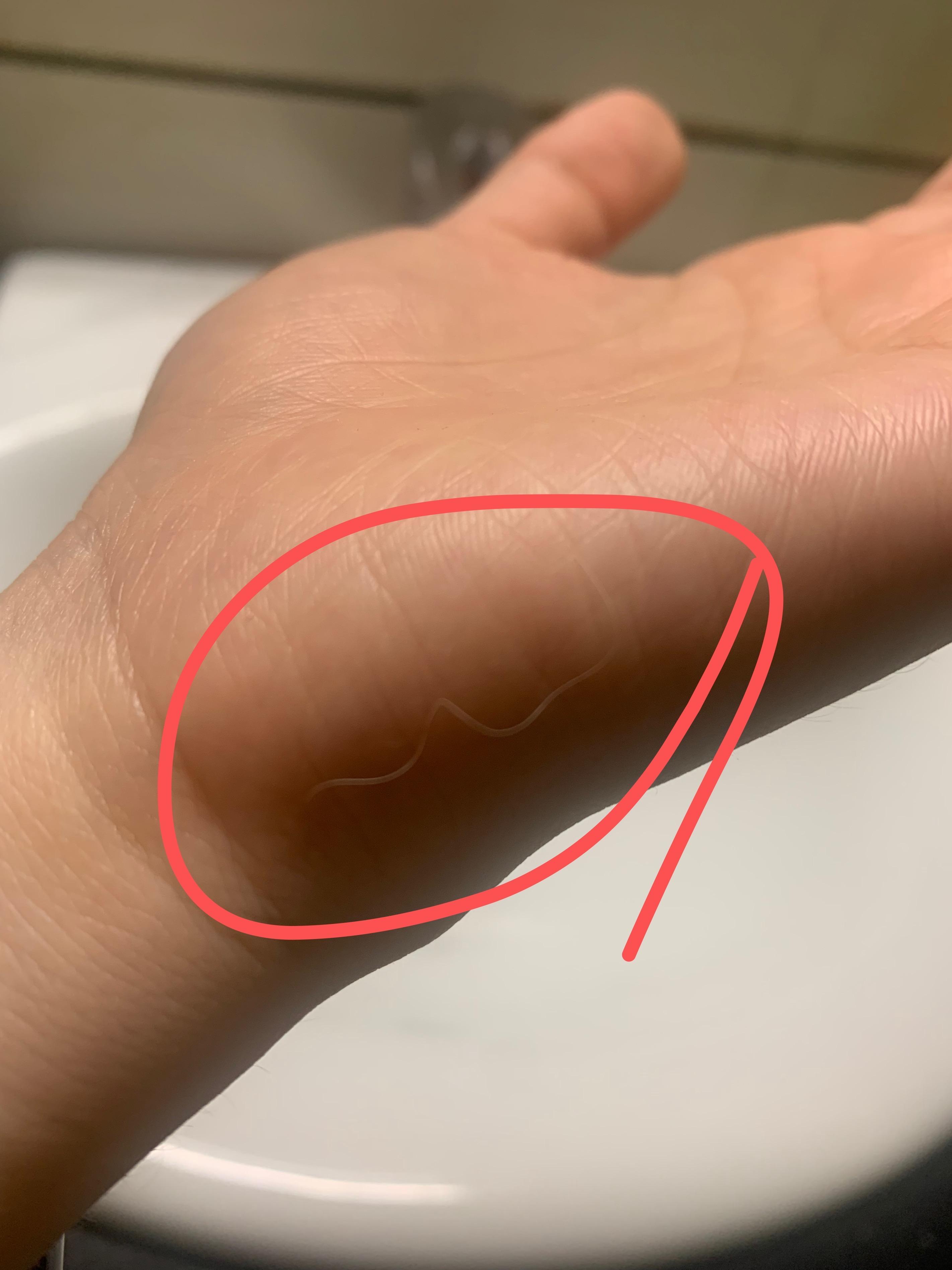 莫吉隆斯症属于反社会型人格障碍吗? - 知乎