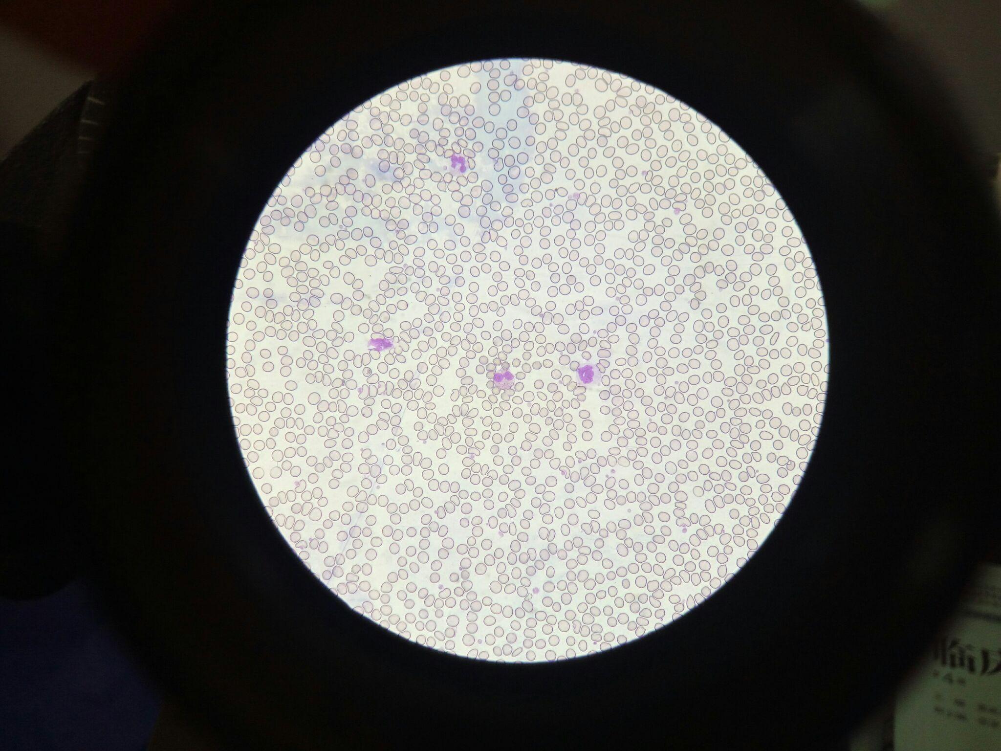 光学显微镜观察血液有何注意事项