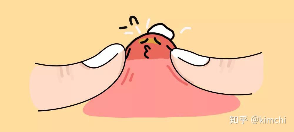 男士如何去黑头