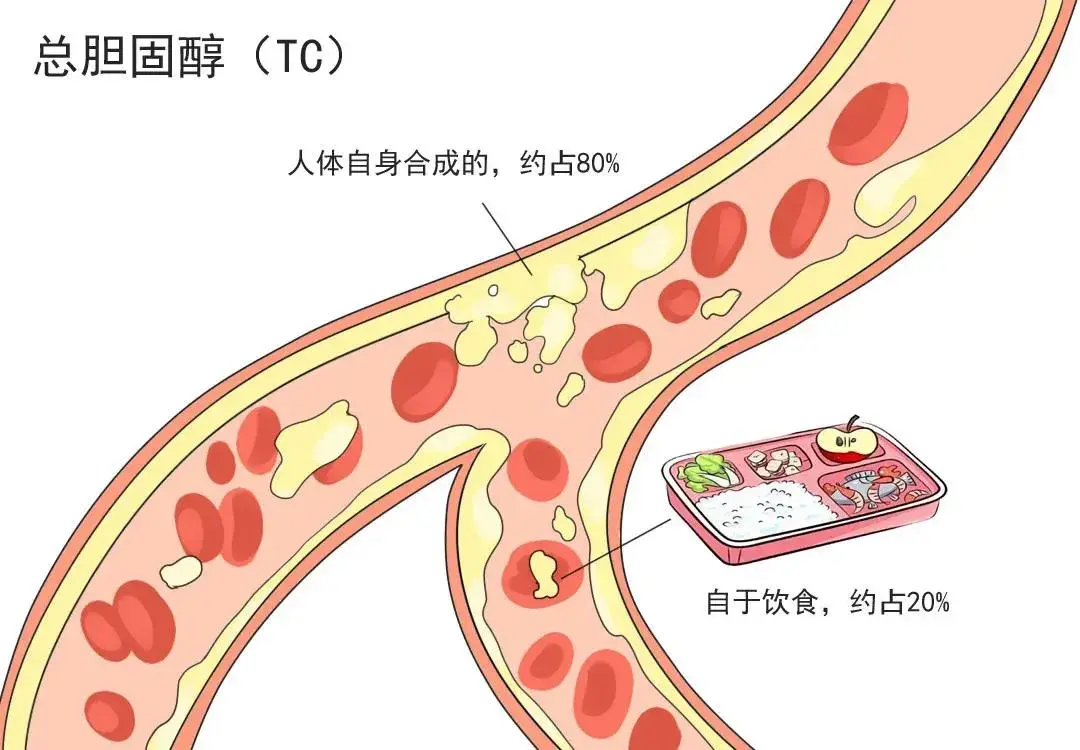 一文秒懂血脂四项 - 知乎