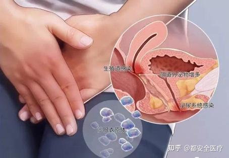 男性衣原体感染症状有哪些? - 知乎