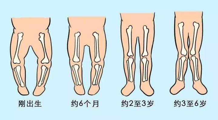 腿部发育宝宝走路更稳