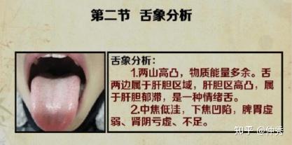 中医舌诊详解大全(独家讲义) - 知乎