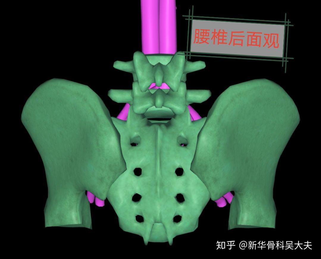 腰5骶1突出和腰45节突出哪个更严重