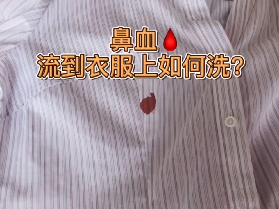 衣服弄上血渍应该怎么清洗?