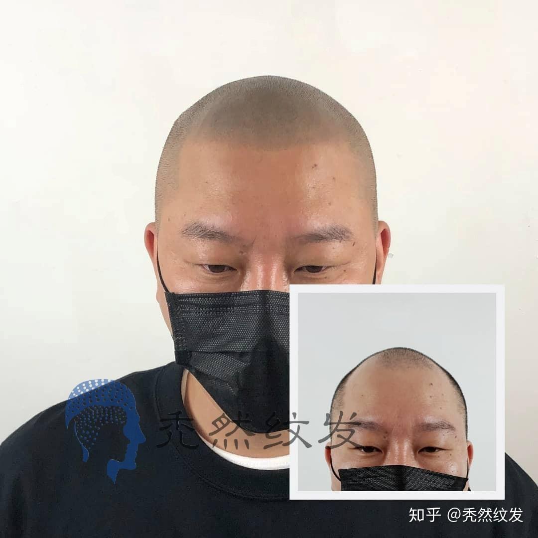 什么是纹发？ - 知乎
