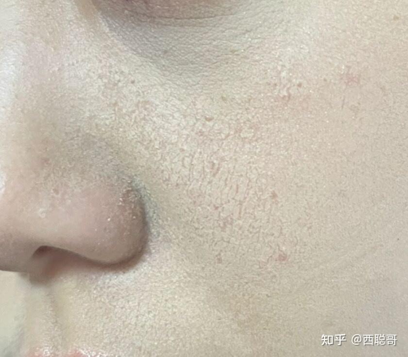 混油皮超级卡粉,起皮,浮粉怎么办?有无护肤品推荐? - 知乎