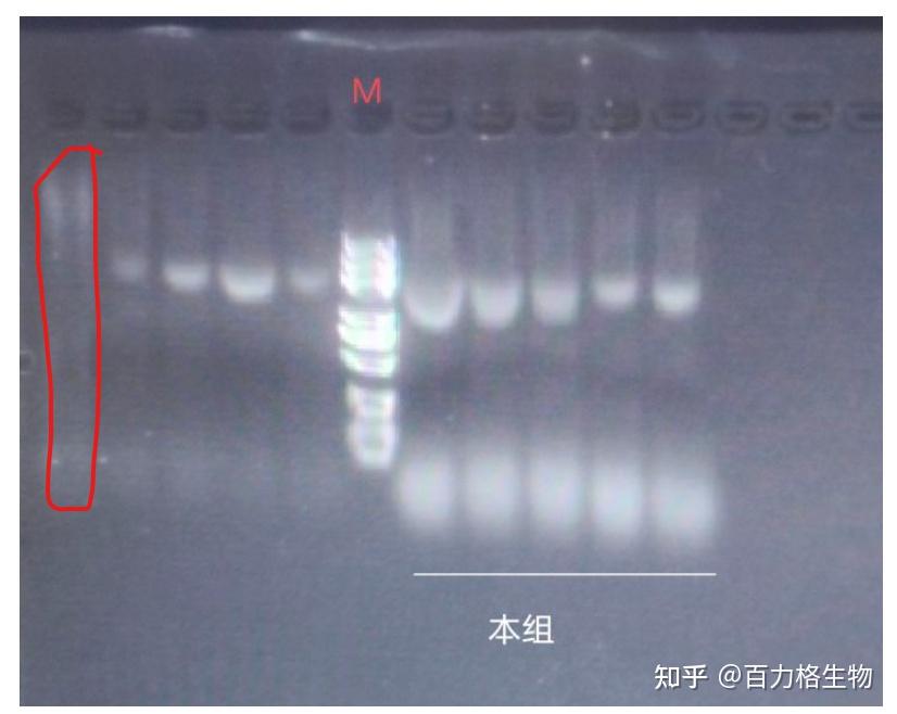 求助。请对该pcr凝胶电泳图进行分析,并指出出现的问题及可能原因? - 知乎