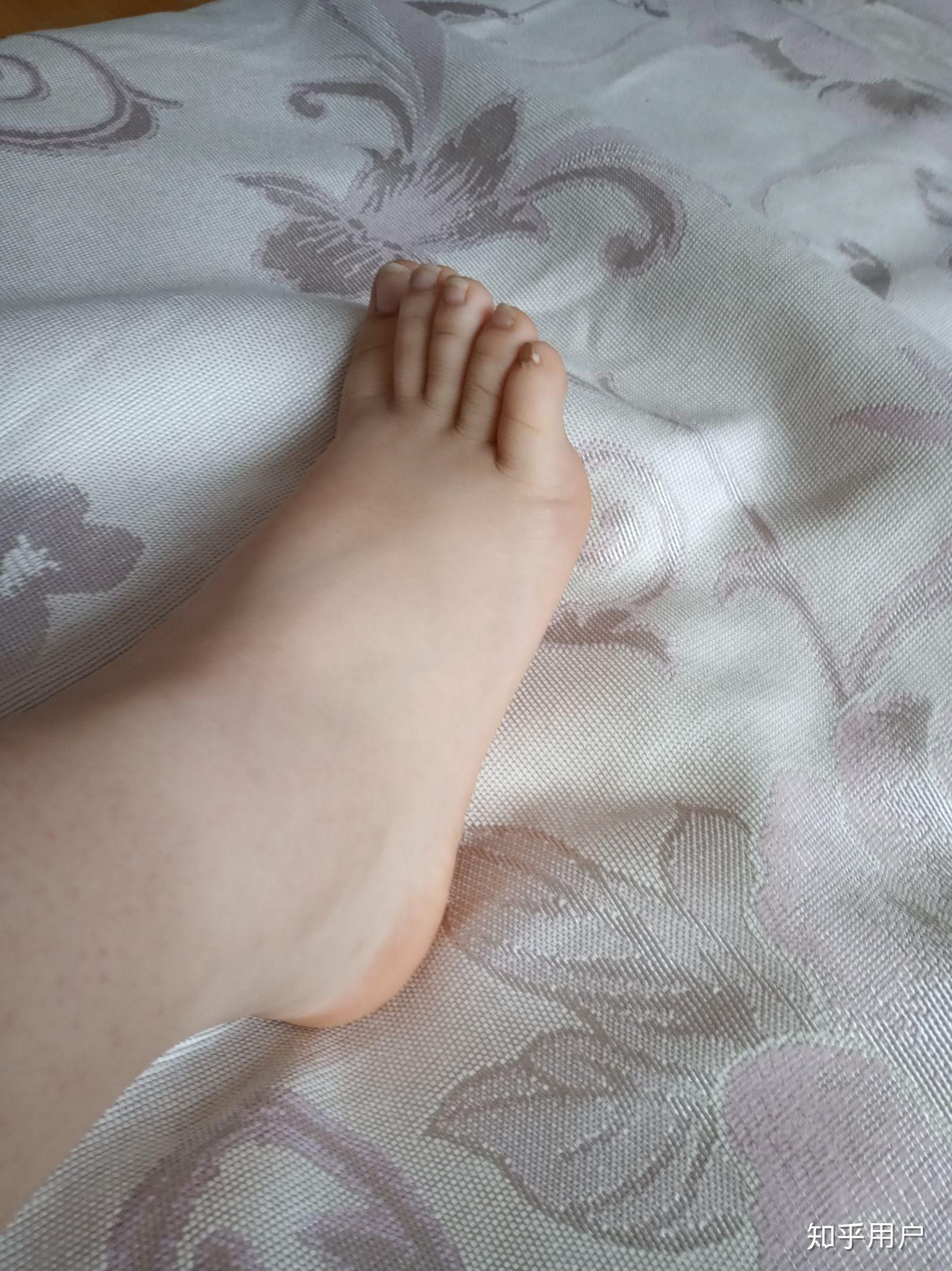 女生脚丑是种什么样的体验