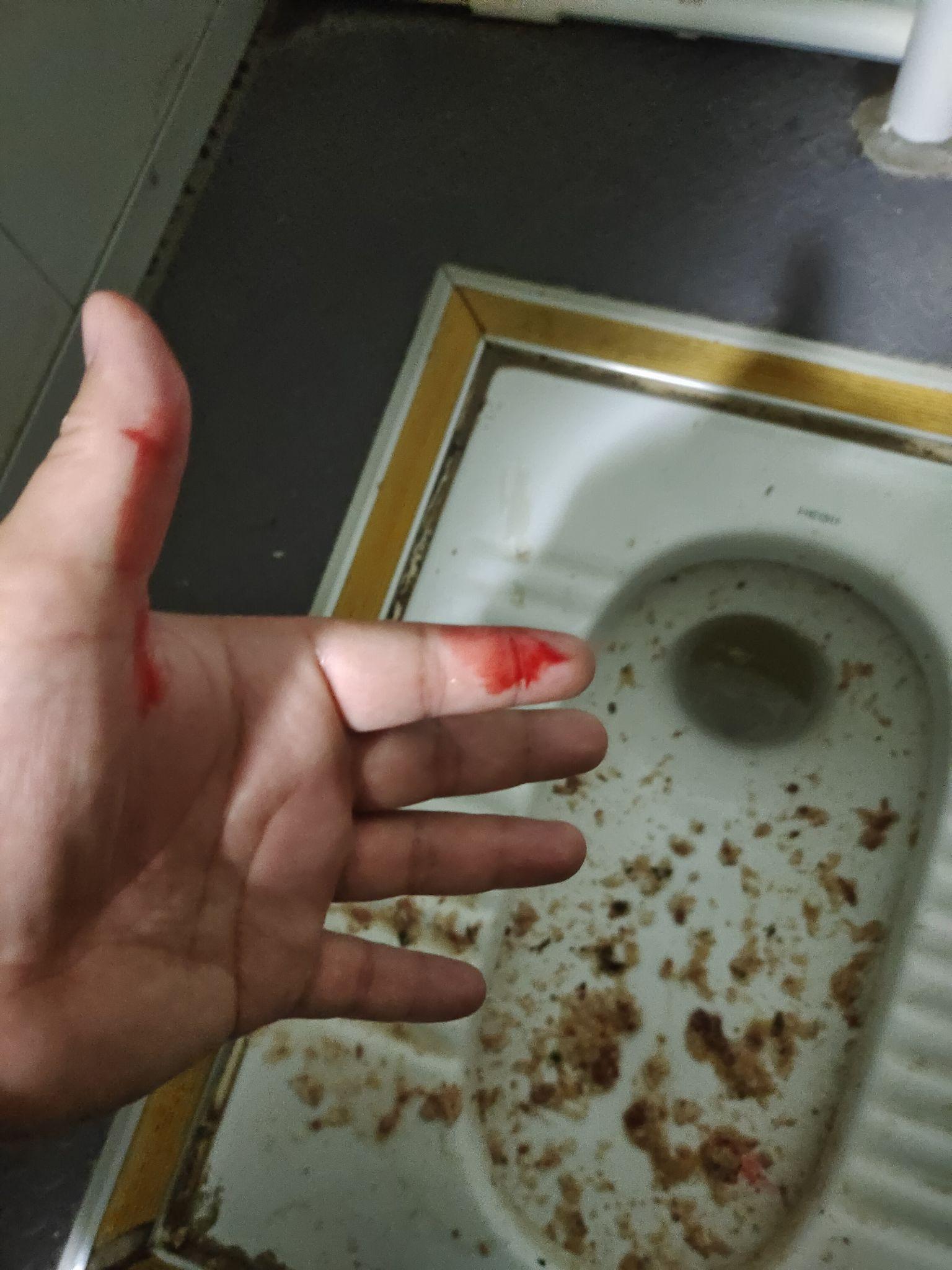 胃出血是一种什么样的体验?