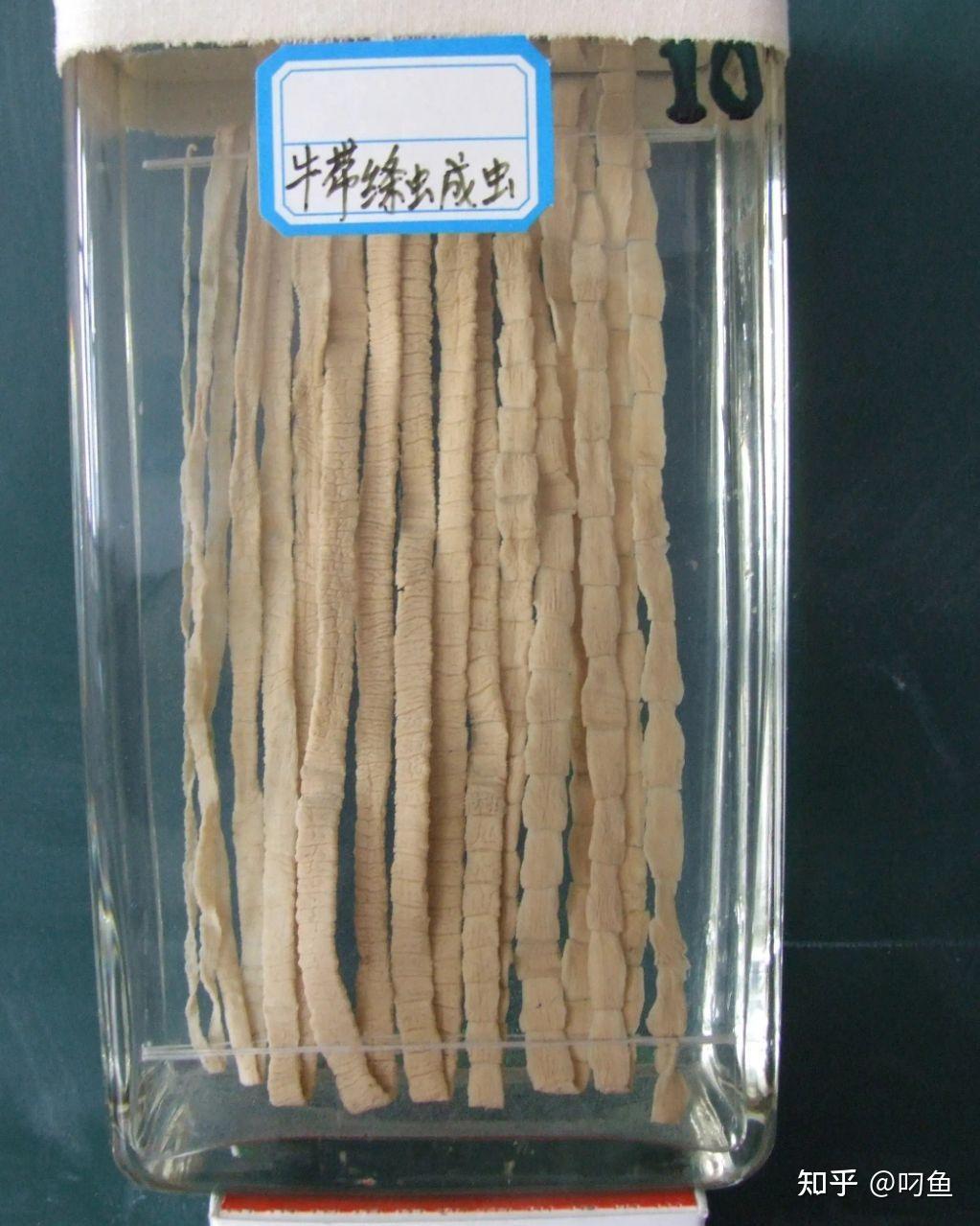 寄生虫讲解 - 知乎
