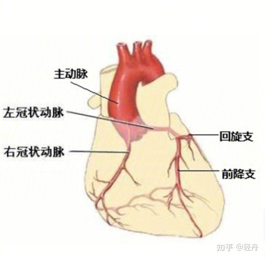 动脉粥样硬化原因图片