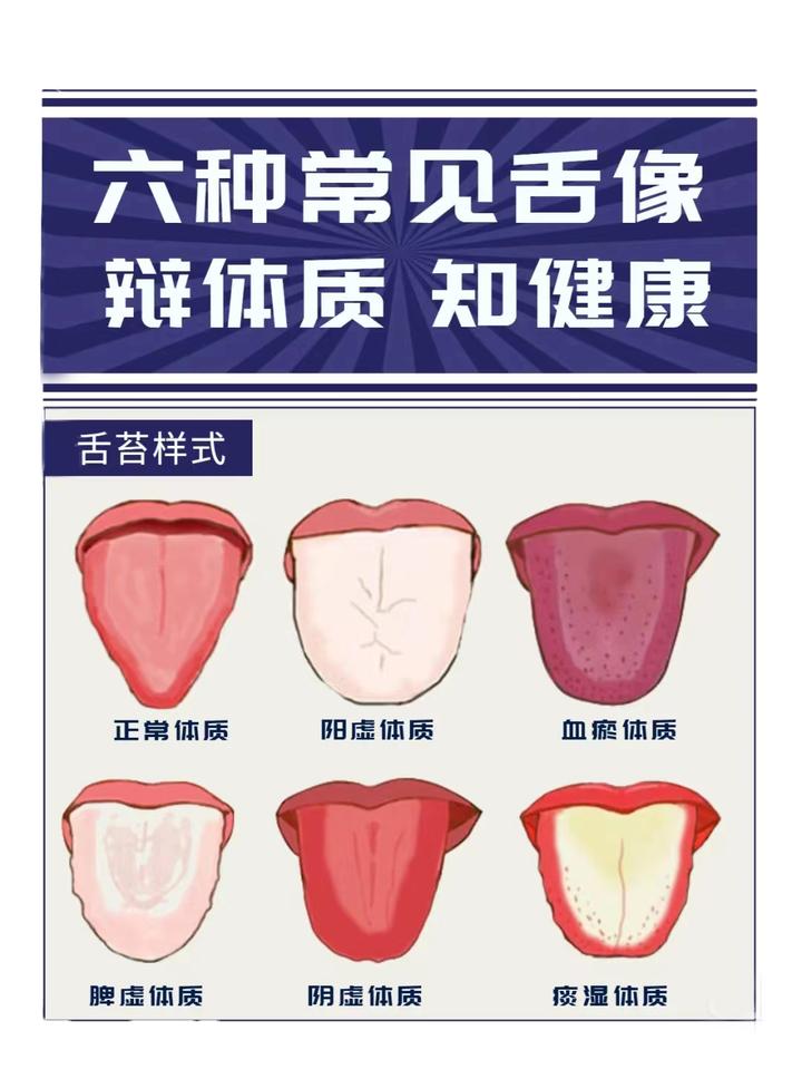 观舌苔看健康,跟中医学舌诊,6种常见舌象 - 知乎