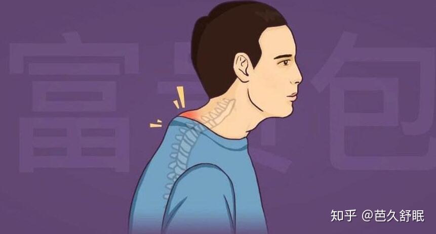 什么是"富贵包"? - 知乎