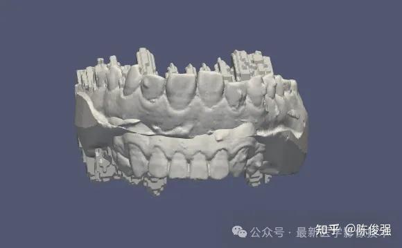 STSR2025——CBCT牙齿分割和CBCT与IOS注册配准 - 知乎