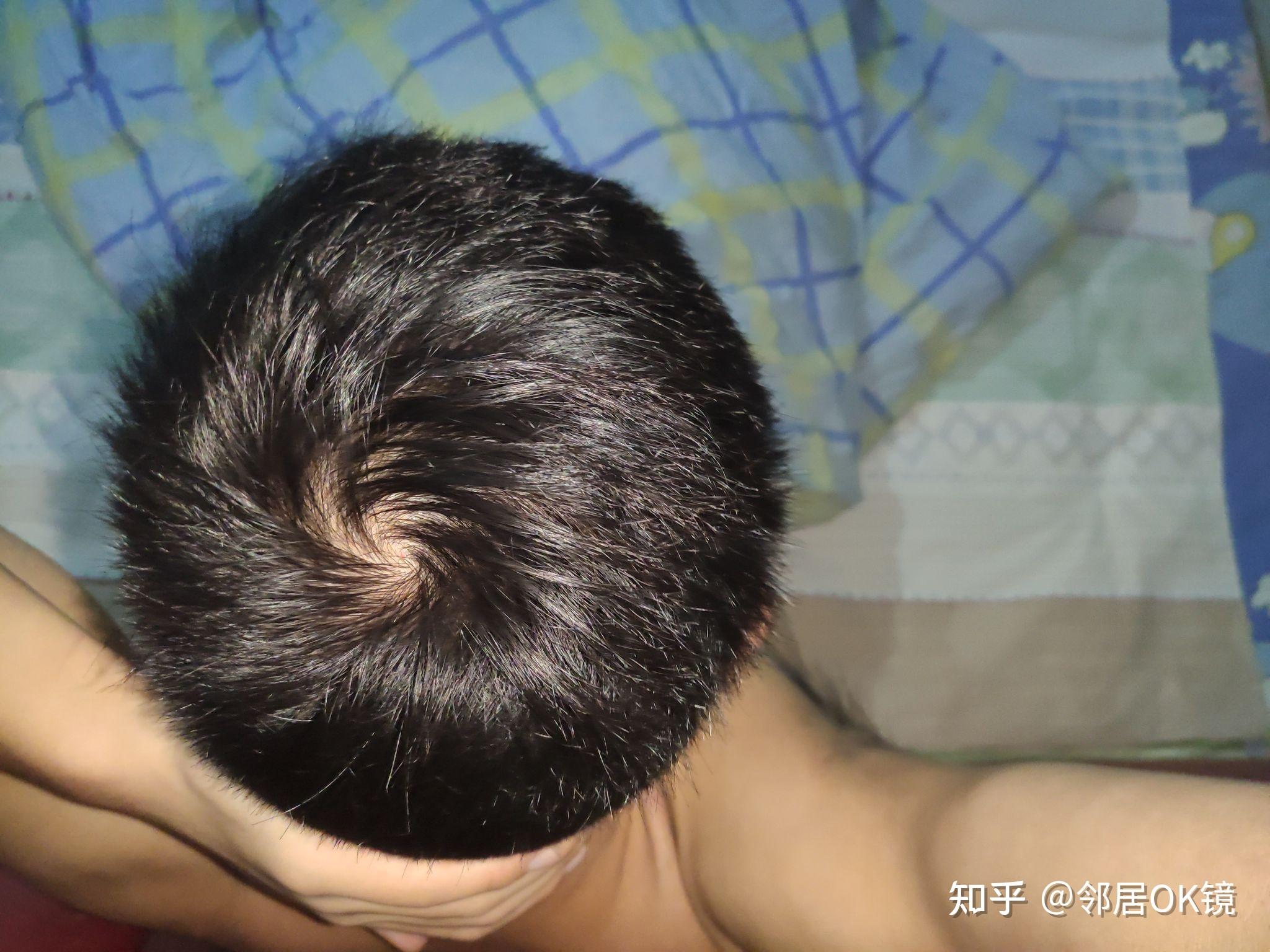 男大三岁为什么不好怀孕百科在线