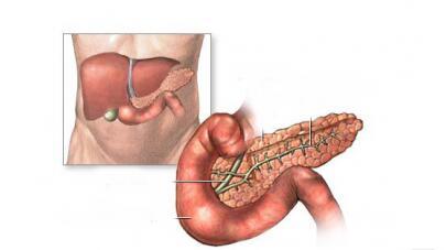 妊娠期急性胰腺炎你瞭解多少